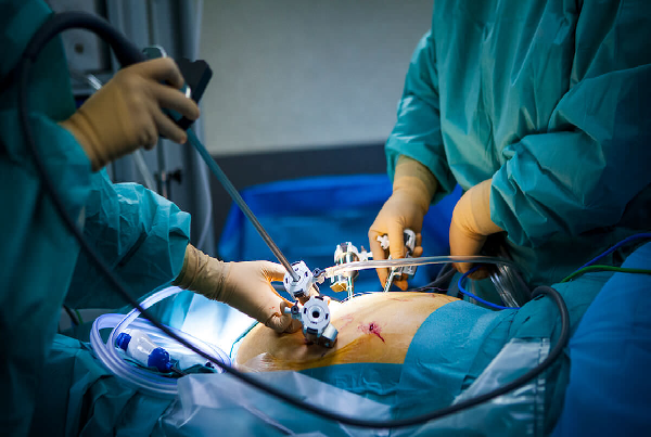 Laparoscopic and Hysteroscopy Gynaecology Surgery